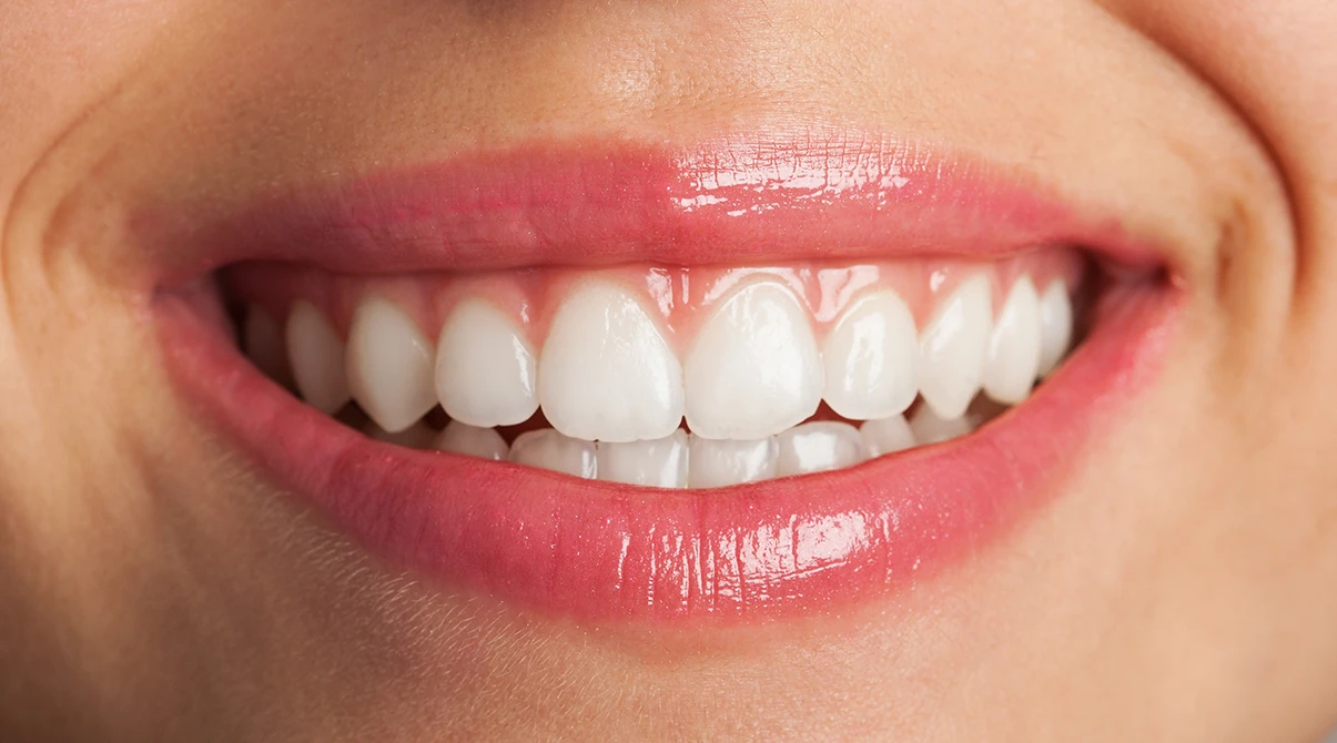 sorriso perfetto parodontologia dentisti macro pordenone